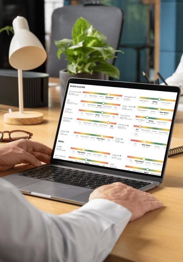 ODX Blood Glucose Sample Results on Laptop ODX Blood Glucose Sample Results on Laptop